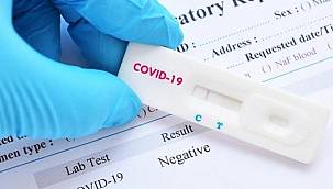 Fırsatçılar devrede! Parayı ver, test yaptırmadan negatif PCR sonucunu al