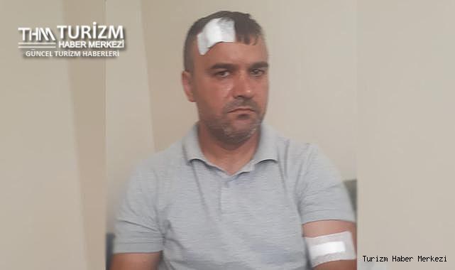 Otel çalışanları tatile gelen müşteriyi darp etti!